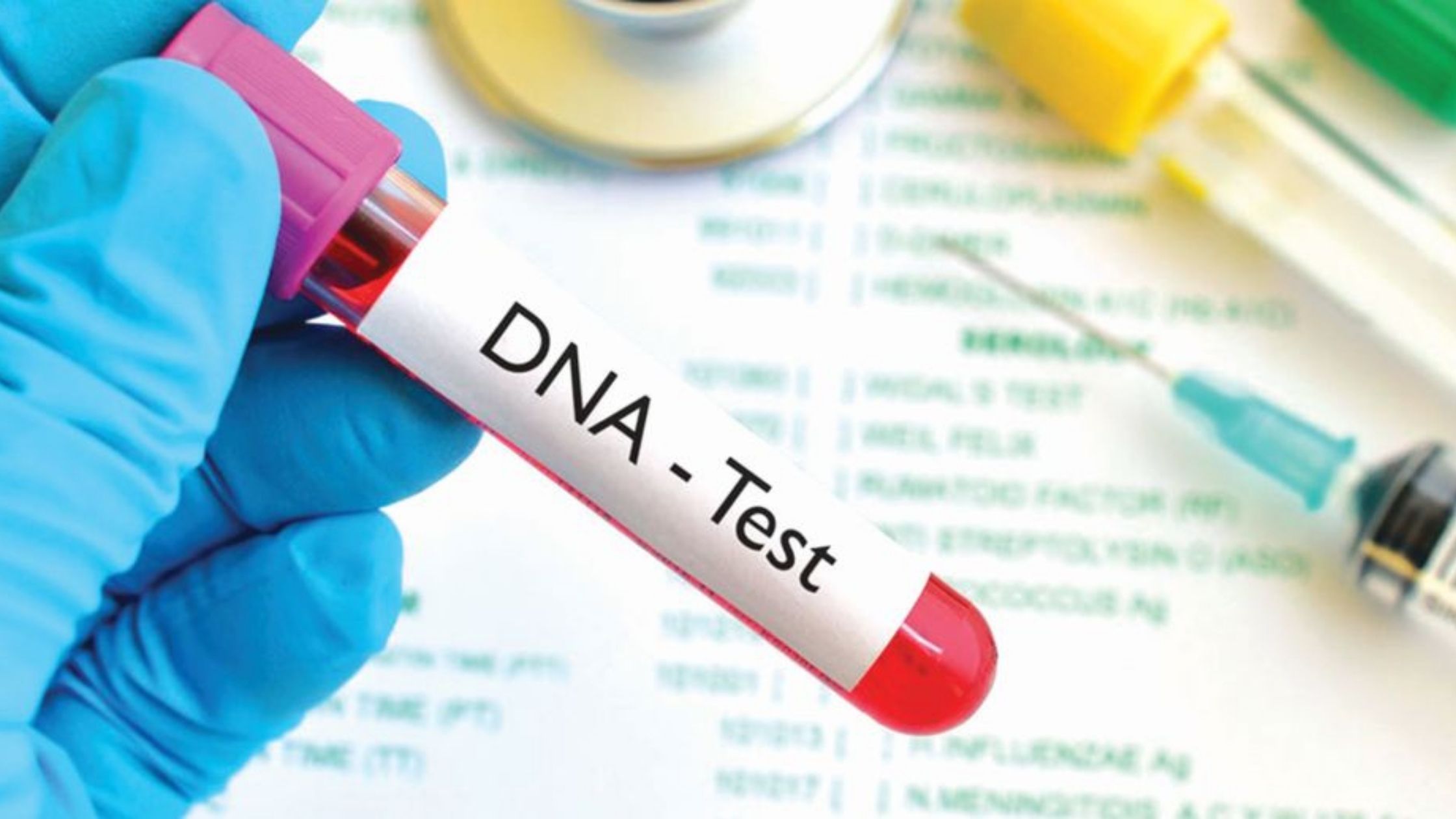DNA Test
