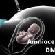 Amniocentesis DNA test
