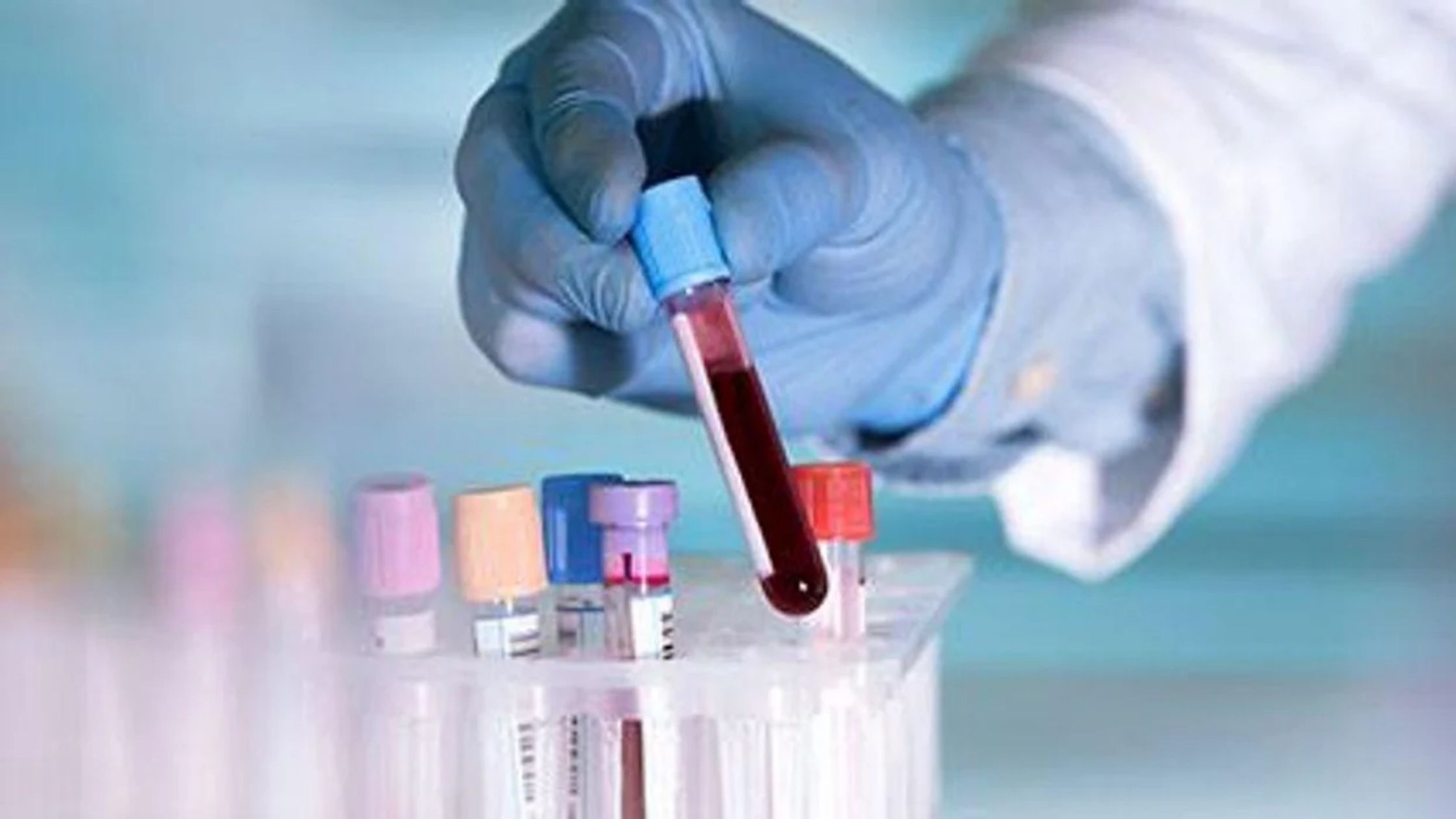 DNA Blood Test
